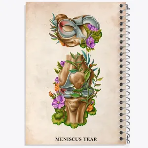 دفتر پارگی منیسک (Meniscus Tear)