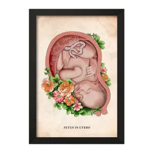 تابلو جنین (Fetus In Utero)