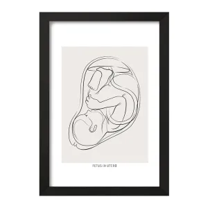 تابلو جنین (Fetus In Utero)